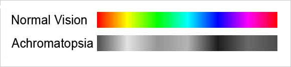 complete color blindness